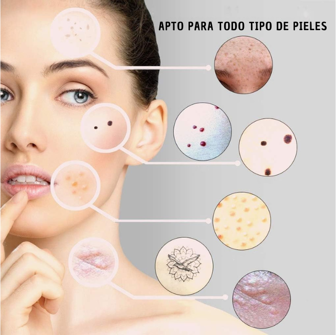PlasmiBelle | Pluma Plasma Pen Quita Verruga Y Pecas