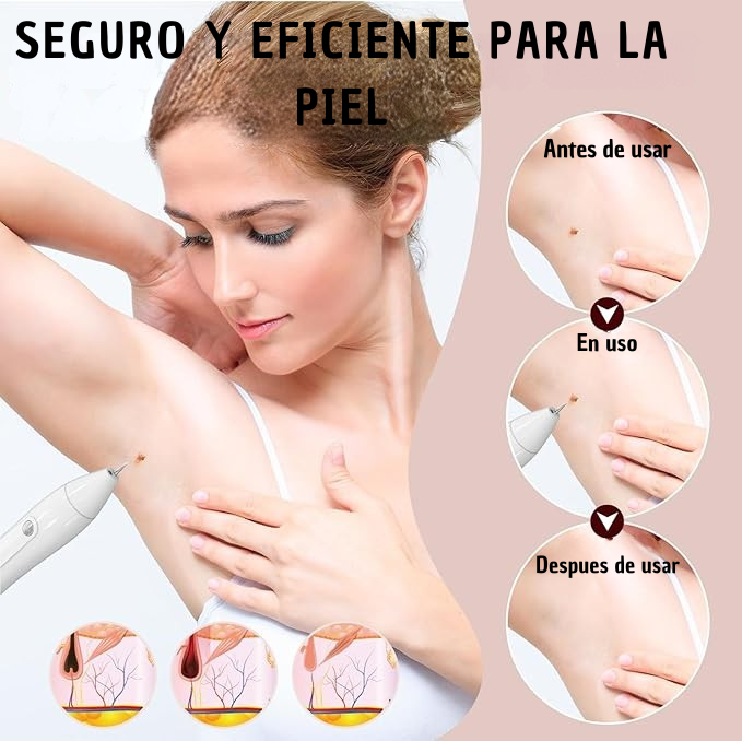 PlasmiBelle | Pluma Plasma Pen Quita Verruga Y Pecas