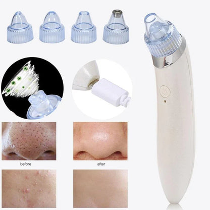 PureSkin™ - Succionador de Puntos Negros + 4 Cabezales de REGALO